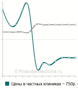 Средняя стоимость эпиляция ресниц в Перми