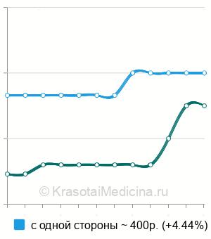 Средняя стоимость пневмомассаж барабанной перепонки в Перми