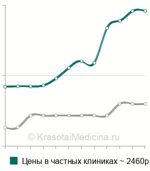Средняя стоимость эхокардиография (ЭхоКГ) в Перми