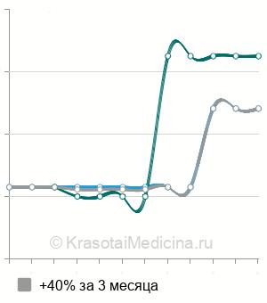 Средняя стоимость контактная уретеролитотрипсия в Перми